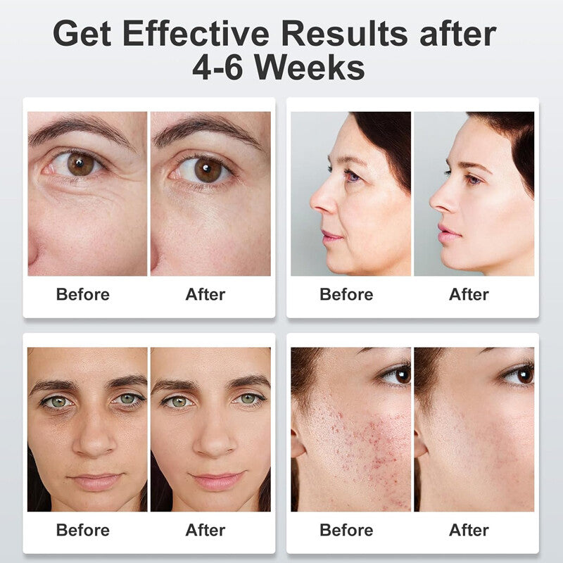7-Color LED Photon Face Mask for Skin &amp; Neck Rejuvenation