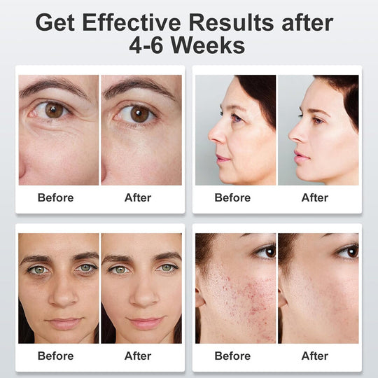 7-Color LED Photon Face Mask for Skin &amp; Neck Rejuvenation